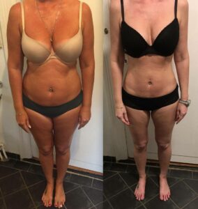 Sanne - 10 kg